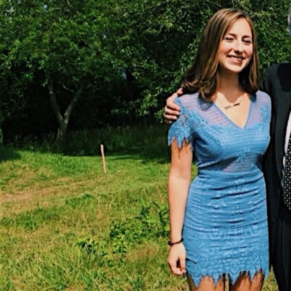 bebe Sky Blue Lace Mini Dress